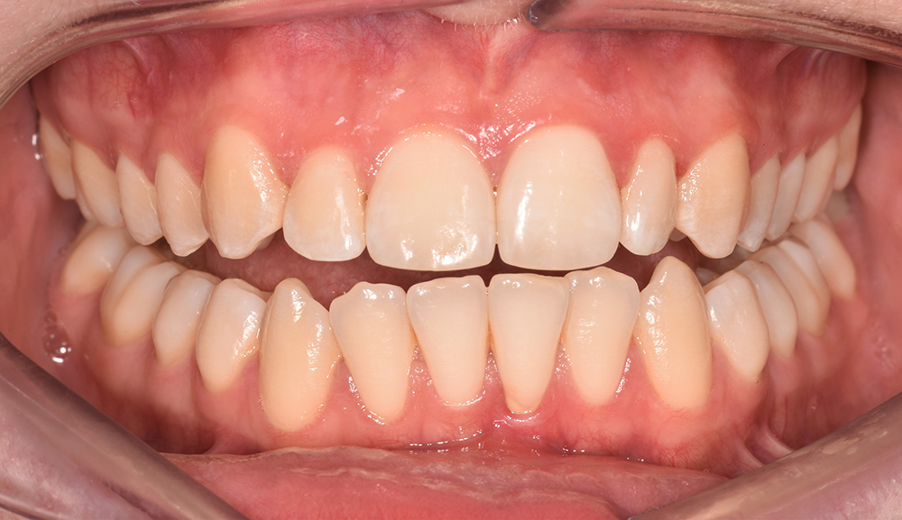 Priestgate Clinic braces