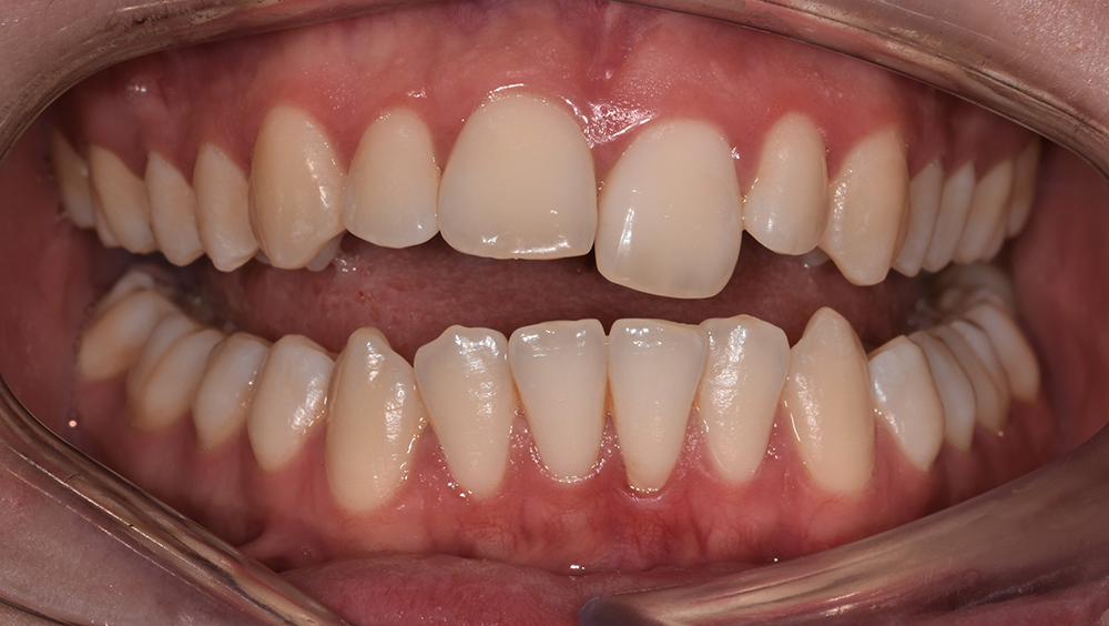 Priestgate Clinic braces