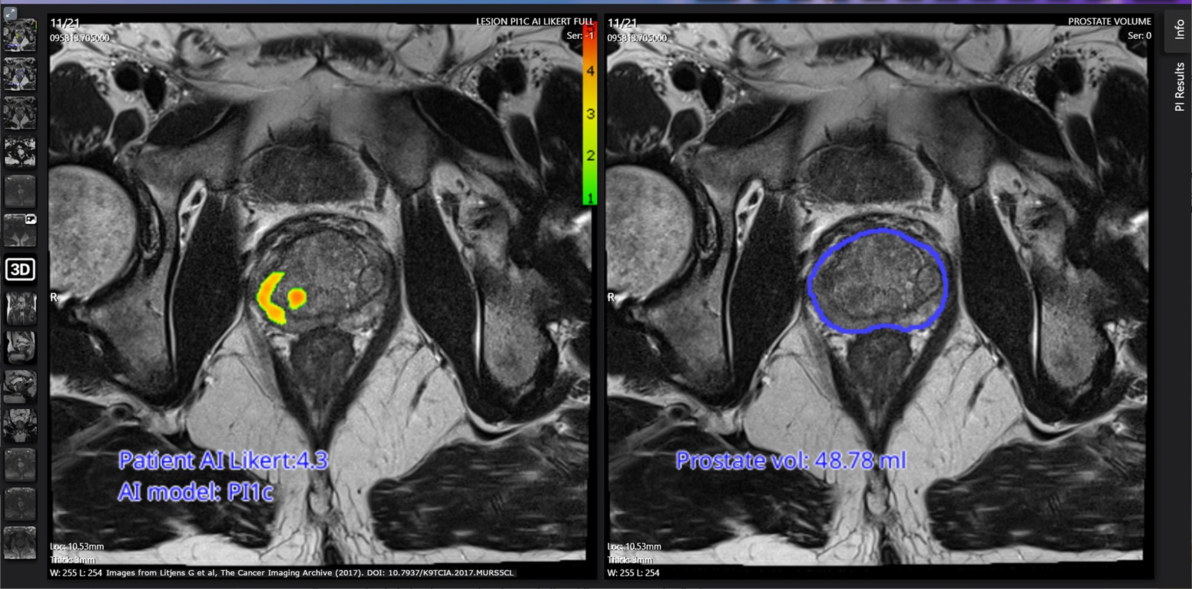 medical scan images